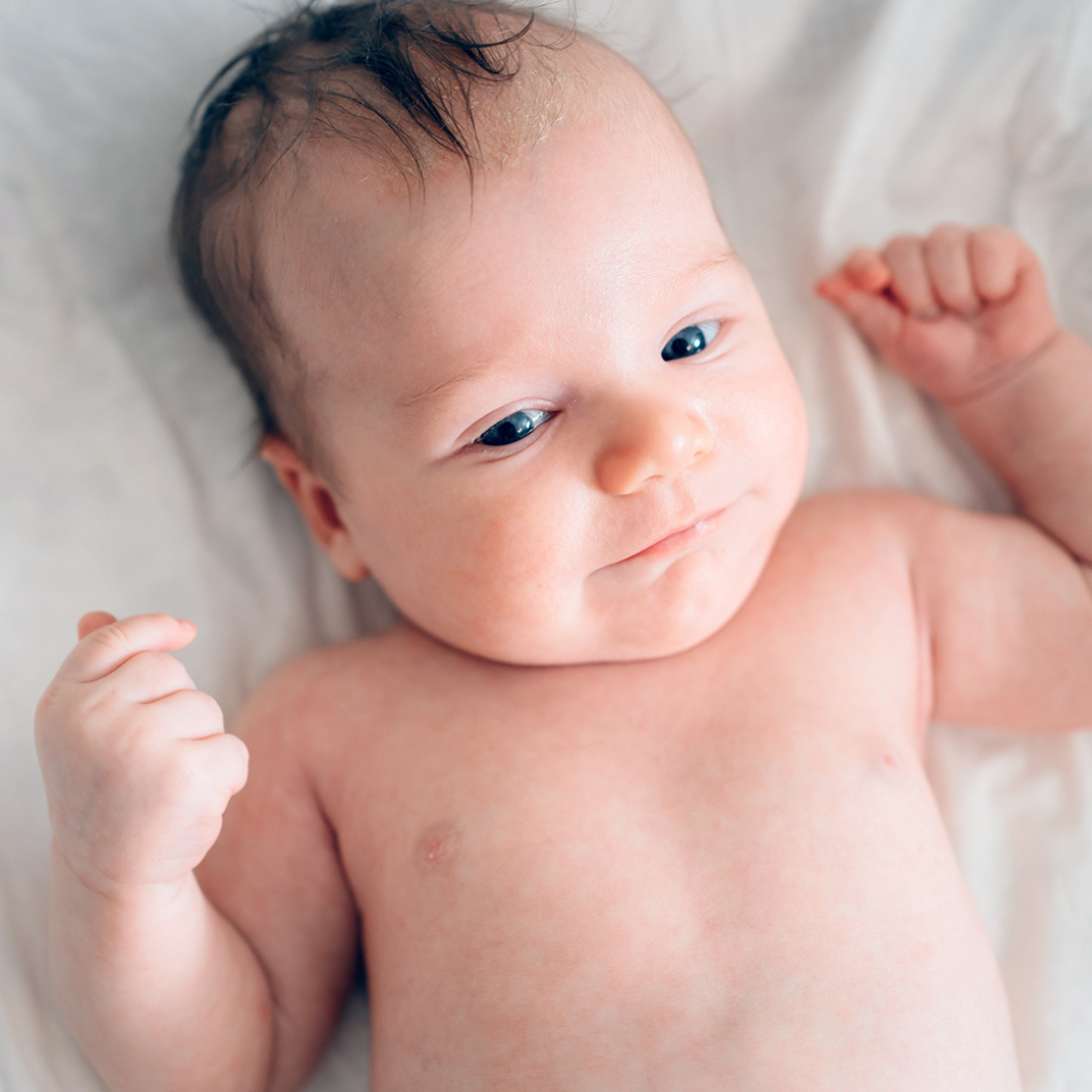 Har din bebis skorv?