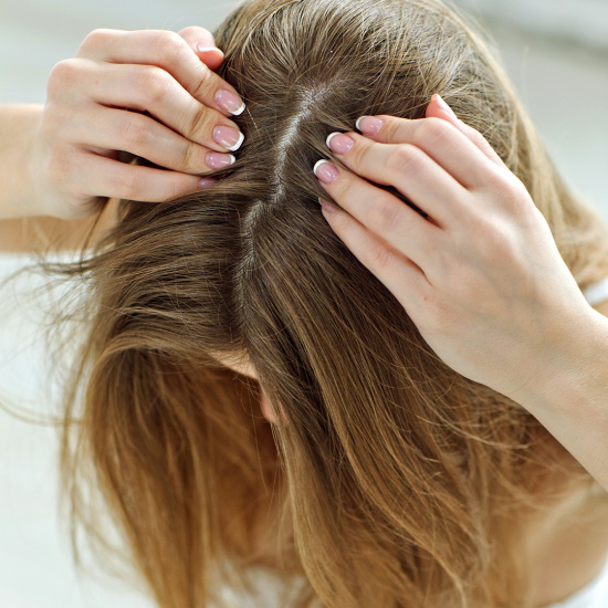 Hur mår din hårbotten?