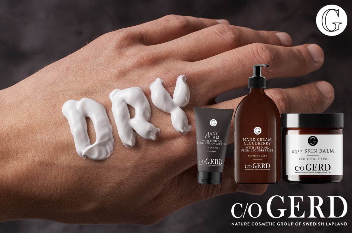 Så här tar du hand om söndertvättade händer <3